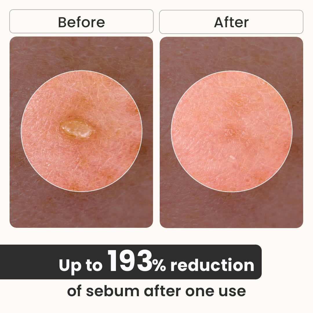 Exfoliating Rice Peel Serum Duo